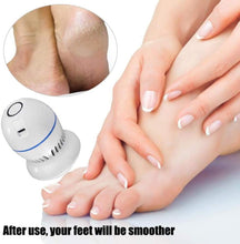 Load image into Gallery viewer, Electric Foot Files Vacuum Callus Remover USB Rechargeable Foot Grinder Callus Remover Feet Care for Hard Cracked Skin