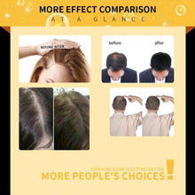 Load image into Gallery viewer, LAVDIK Ginger Fast Hair Growth Serum Essential Oil Anti Preventing Hair Lose Liquid Damaged Hair Repair Growing Dropship TSLM1