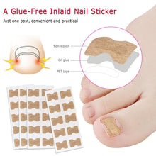 Load image into Gallery viewer, 1/5pc Non-Glue Toenail Patch Ingrown Toenail Correction Pedicure Tool Toe Inlay Nail Corrector Nail Patch Correction Stickers