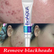 Load image into Gallery viewer, Bioaqua 30g Acne Treatment Blackhead Remova Anti Acne Cream Oil Control Shrink Pores Acne Scar Remove Face Care Whitening