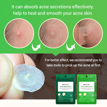 Load image into Gallery viewer, BREYLEE Acne Pimple Patch Face Mask Skin Care Acne Treatment Serum Face Cream Acne Cream Essence Sheet Mask Facial Care Tools