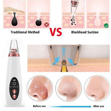 Load image into Gallery viewer, Pore Cleaner Blackhead Remover Vacuum Face Skin Care Suction Black head Black Dots Blackheads Pimples Removal Deep Cleaning Tool
