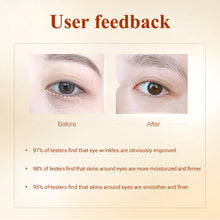 Load image into Gallery viewer, LANBENA Eye Mask Collagen Eye Patch Skin Care Hyaluronic Acid Gel Moisturizing Retinol Anti Aging Remove Dark Circles Eye Bag