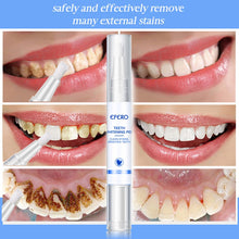 Load image into Gallery viewer, EFERO Teeth Whitening Pen Cleaning Serum Remove Plaque Stains Dental Tools Whiten Teeth Oral Hygiene Tooth Whitening Pen 1Pcs
