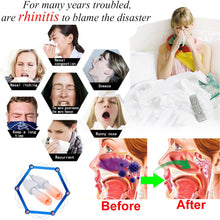 Load image into Gallery viewer, Dropshipping 1 PC Nose Care Rhinitis Sinusitis Cure Therapy Massage Hay Fever Low Frequency Pulse Laser Nose Health Care Machine
