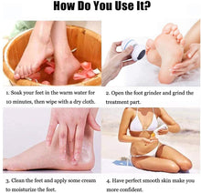 Load image into Gallery viewer, Electric Foot Files Vacuum Callus Remover USB Rechargeable Foot Grinder Callus Remover Feet Care for Hard Cracked Skin

